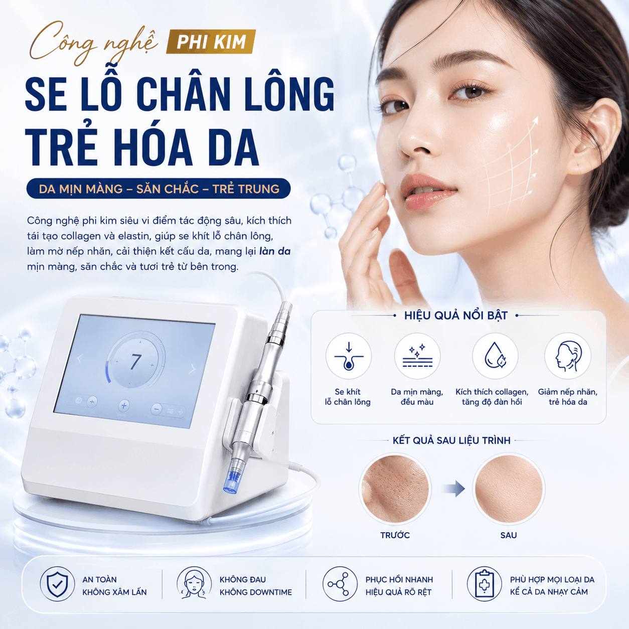 Phi kim - Microneedling